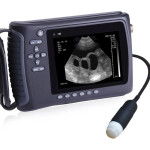 3D/4D Portable Ultrasound Machine